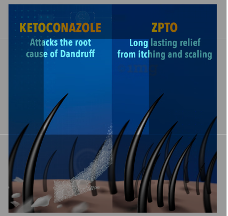 Scalpe+ Expert Anti Dandruff | Hair Care Shampoo - Image 4