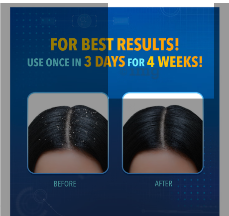 Scalpe+ Expert Anti Dandruff | Hair Care Shampoo - Image 6