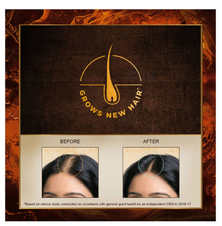 Indulekha Bringha Oil Reduces Hair Fall and Grows New Hair Oil - Image 6