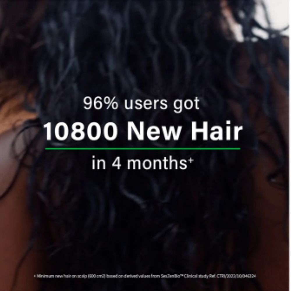 Oziva Hair Vitamins with DHT Blocker & Omega 3 | Vegetarian Capsule for Better Hair Growth & Hair Fall Control - Image 5