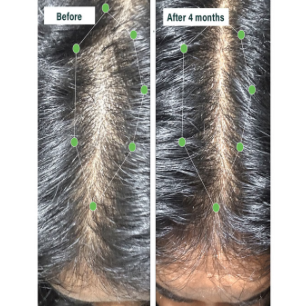 Oziva Hair Vitamins with DHT Blocker & Omega 3 | Vegetarian Capsule for Better Hair Growth & Hair Fall Control - Image 2